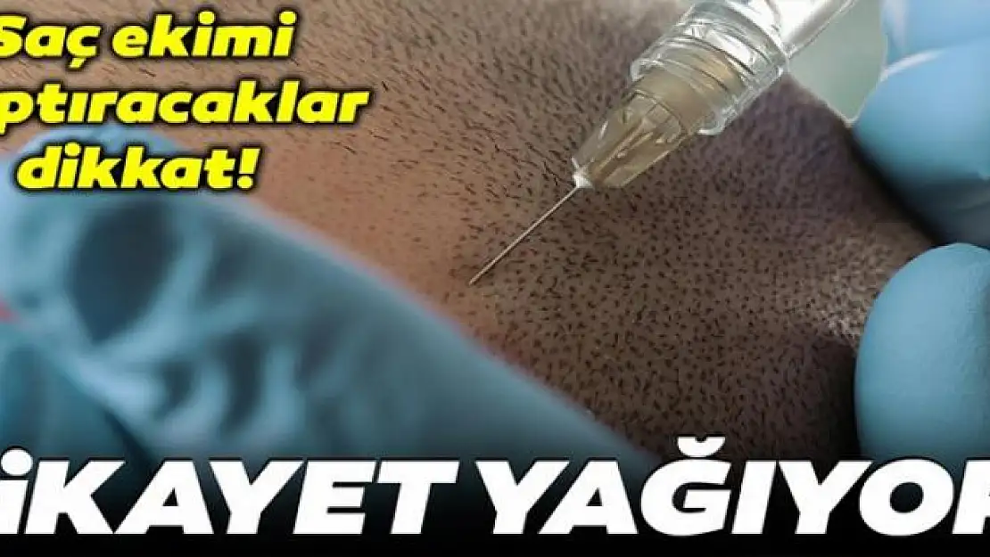 Saç ekimi yaptırmak isteyenler dikkat! Seyyar saç ekiciler türedi