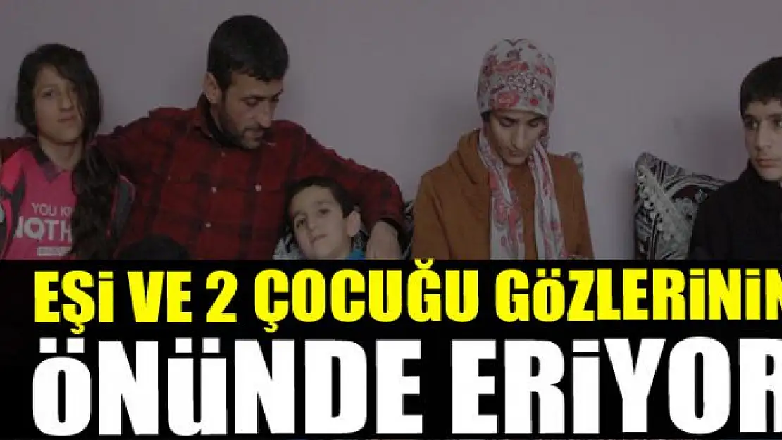 Eşi ve 2 çocuğu gözlerinin önünde eriyor