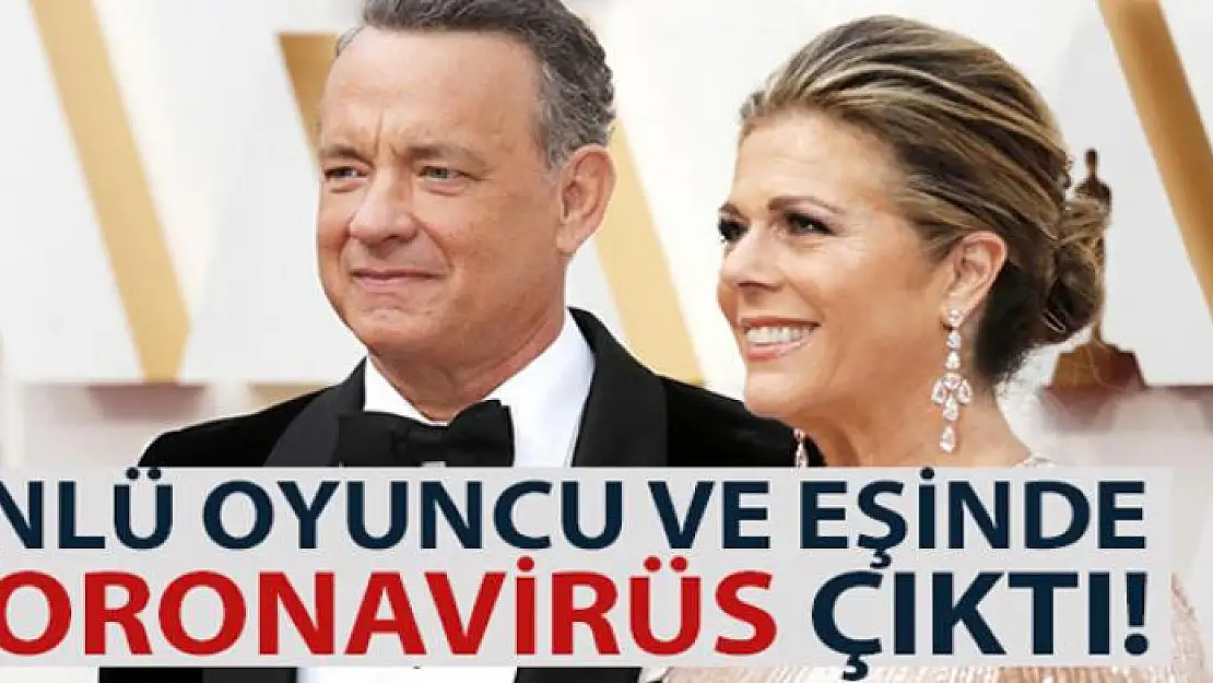 ABD'li ünlü aktör Tom Hanks ve eşi virüse yakalandı