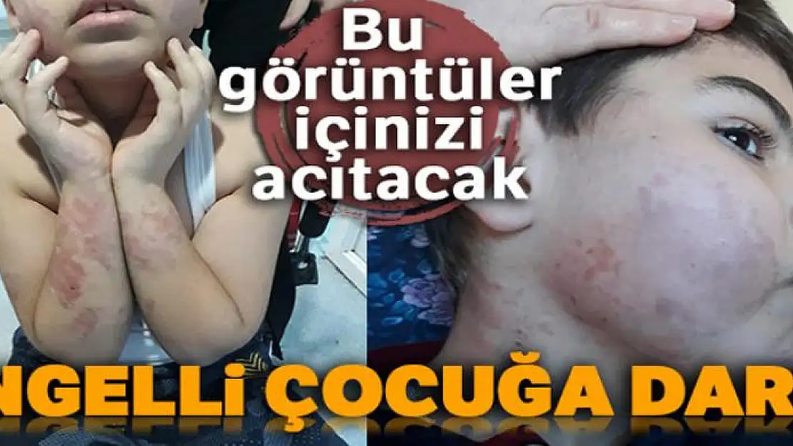 Uşak'ta engelli çocuğa darp iddiası