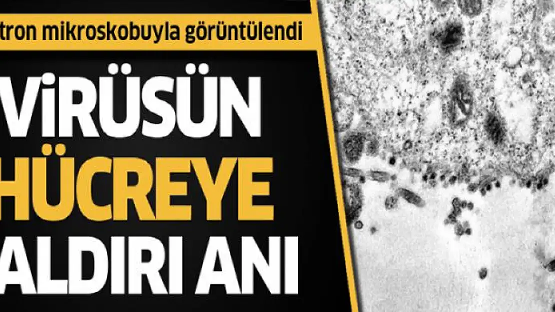 Koronavirüsün hücreye saldırı anı böyle görüntülendi