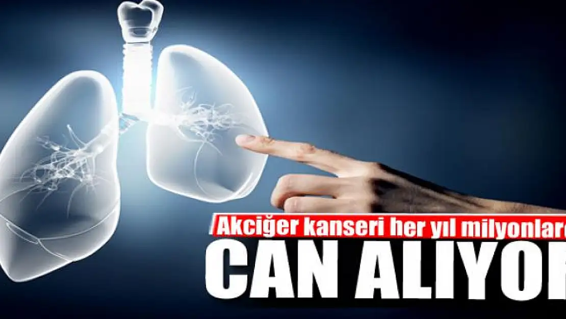 Akciğer kanseri her yıl milyonlarca can alıyor