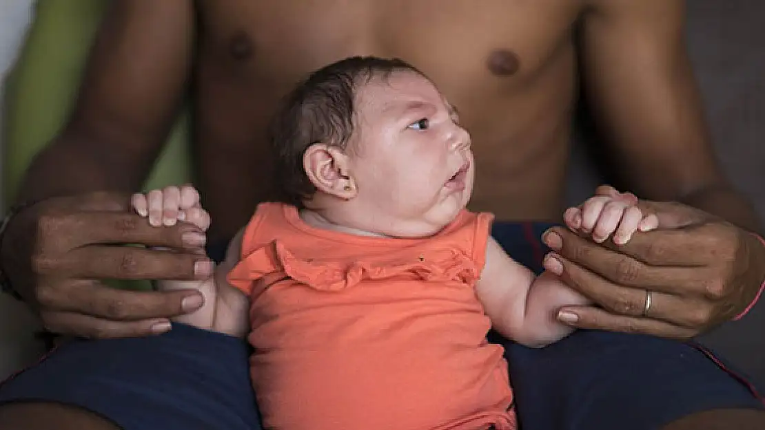 Zika Salgınında cinsel ilişki Uyarısı!