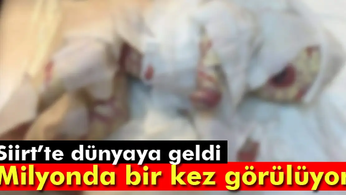 Siirtte dünyaya geldi: Milyonda bir kez görülüyor