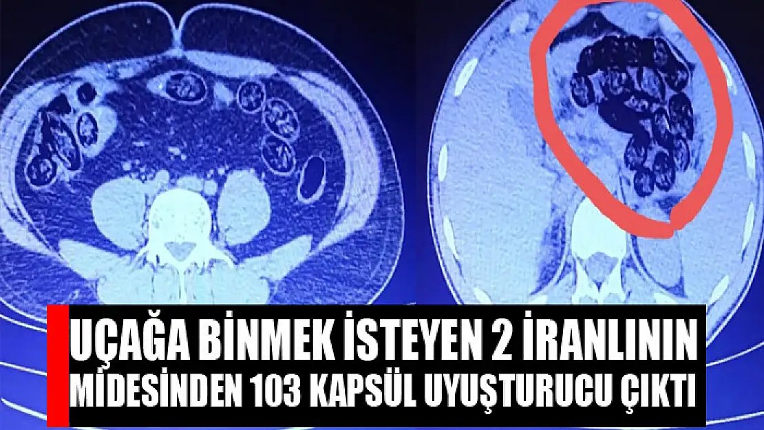 Uçağa binmek isteyen 2 İranlının midesinden 103 kapsül uyuşturucu çıktı