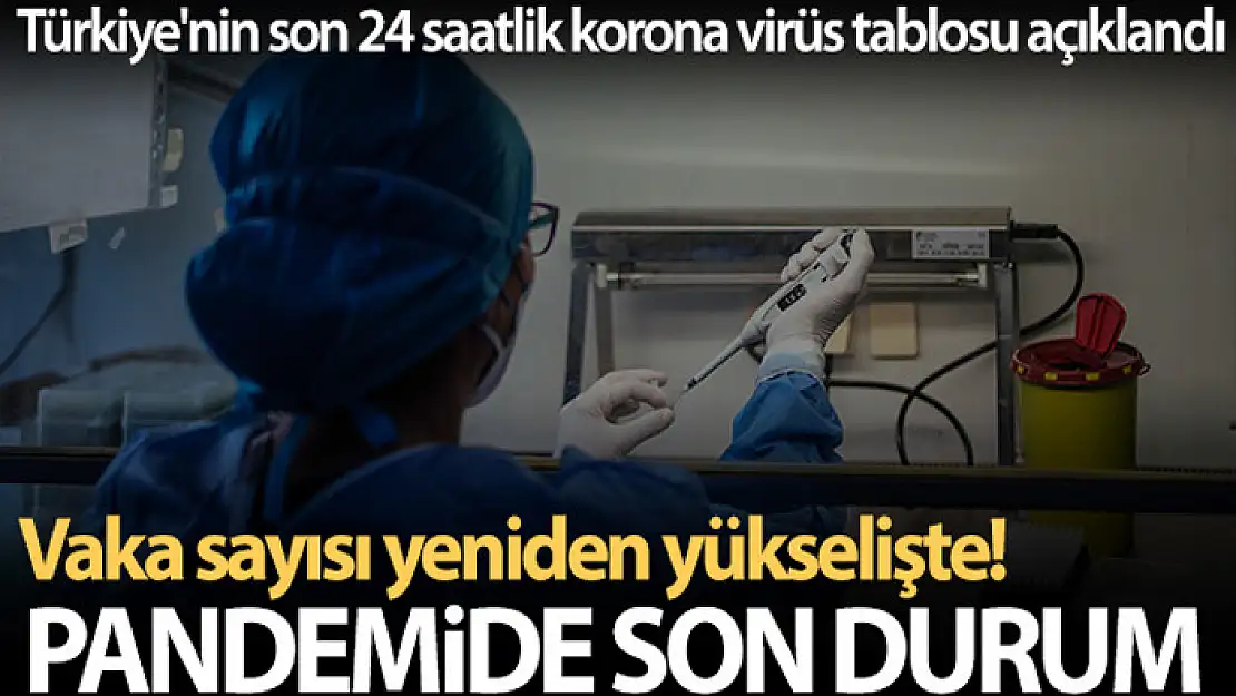 Son 24 saatte korona virüsten 346 kişi hayatını kaybetti