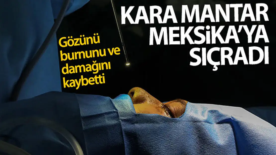 Kara mantar hastalığı Meksika'ya da sıçradı