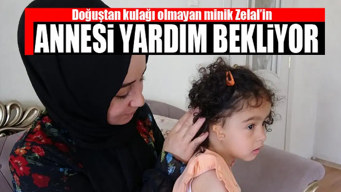 Doğuştan kulağı olmayan minik Zelal'in annesi yardım bekliyor