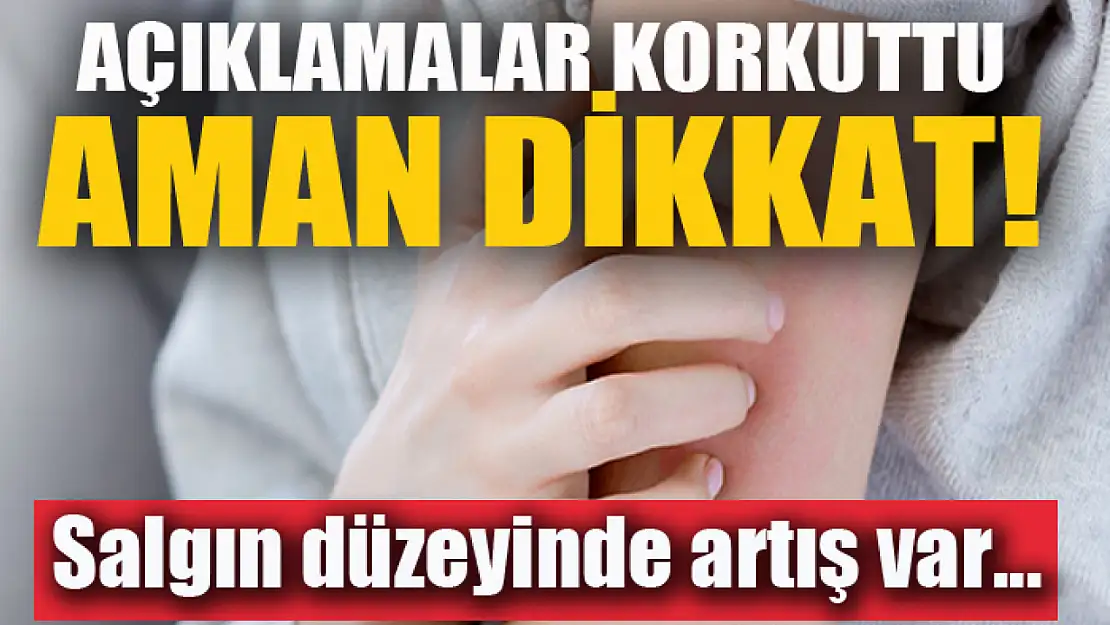 Aman dikkat! Salgın düzeyinde artış var