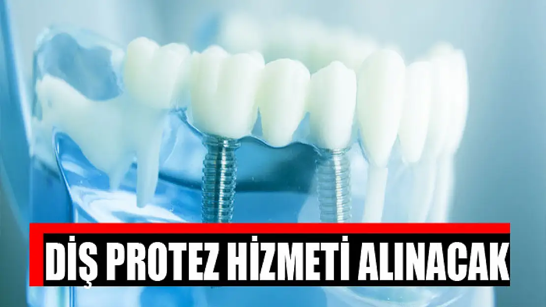 Diş protez hizmeti alınacak