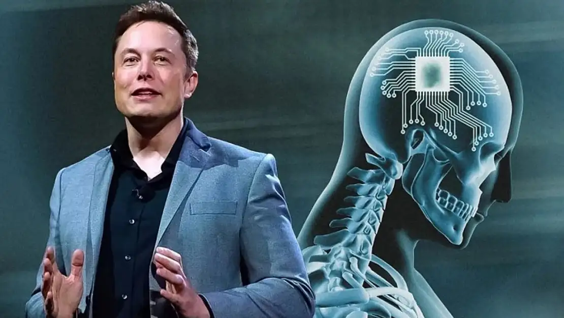 Elon Musk'ın yeni projesi 'Neuralink' için 320 milyon dolar yatırım