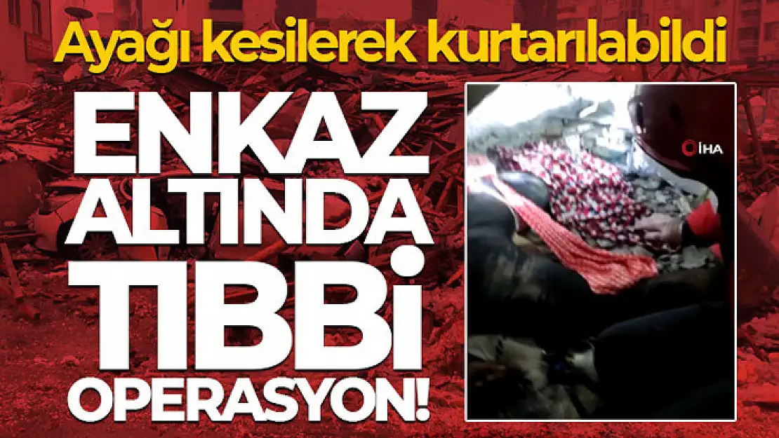 Enkaz altında tıbbi operasyon! Ayağı kesilerek kurtarılabildi