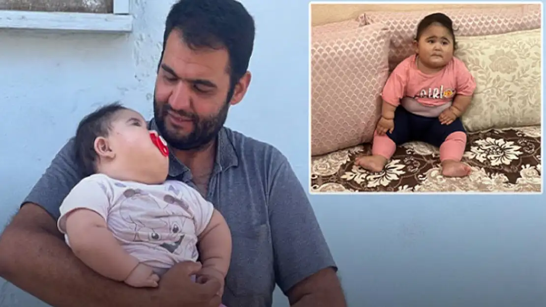 Gülistan bebek hızla kilo alıyor! 11 ayda 20 kilo
