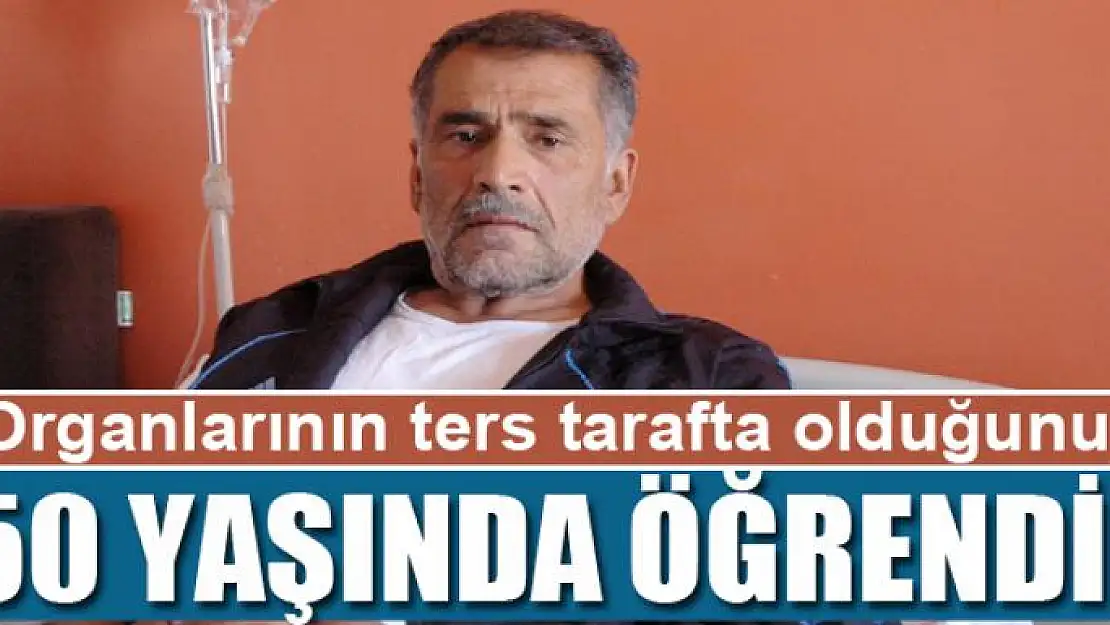 Organlarının ters tarafta olduğunu 50 yaşında öğrendi 