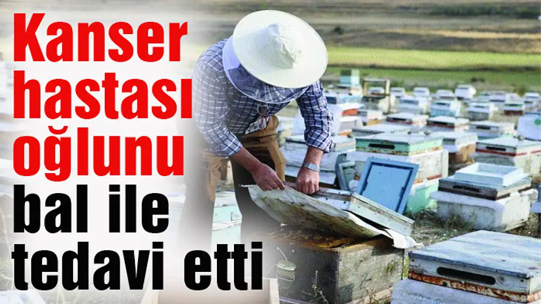 Kanser hastası oğlunu bal ile tedavi etti