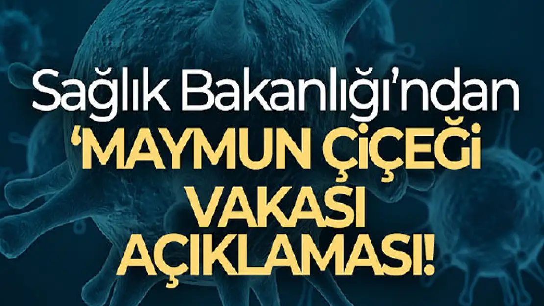 Sağlık Bakanlığı: Ülkemizde bugüne kadar 'maymun çiçeği' vakası görülmemiştir