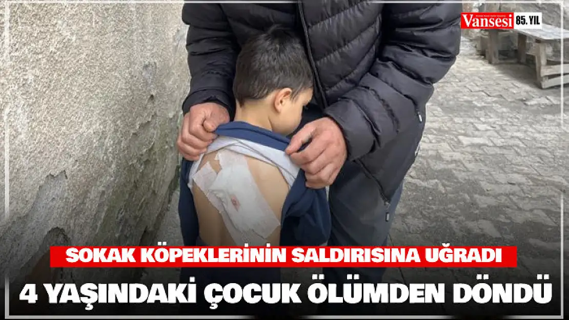 Sokak köpeklerinin saldırdığı 4 yaşındaki çocuk ölümden döndü