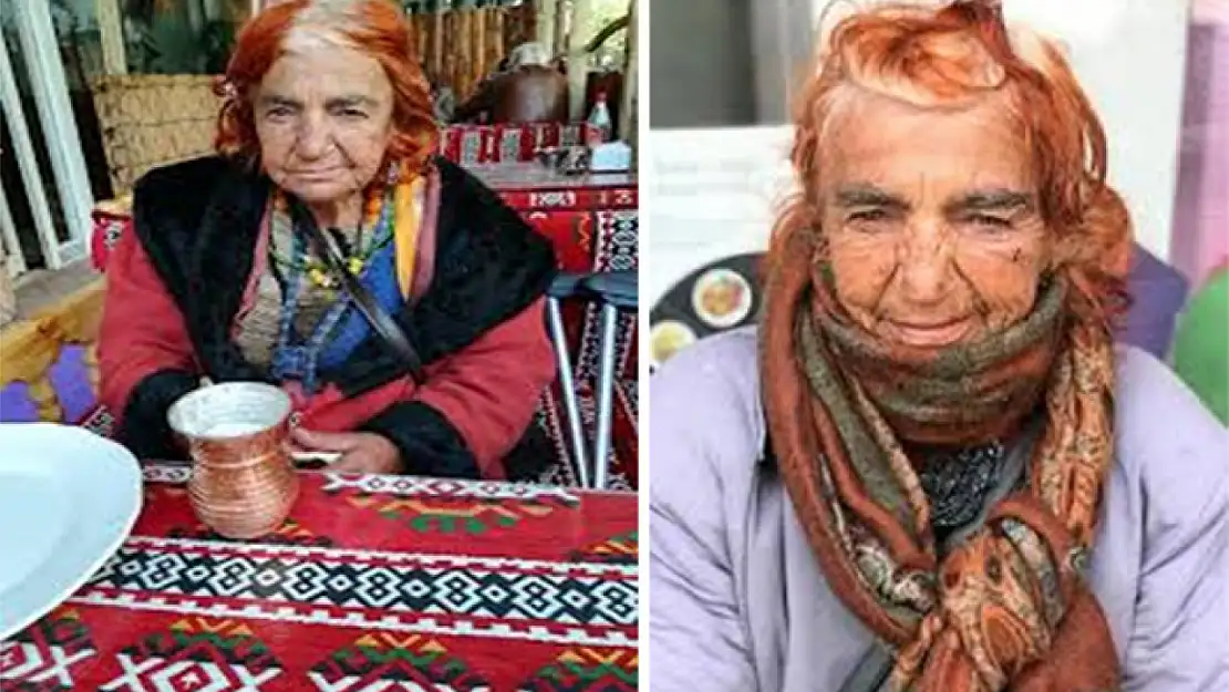 Van'ın Fadile Teyzesi hastalıkla boğuşuyor