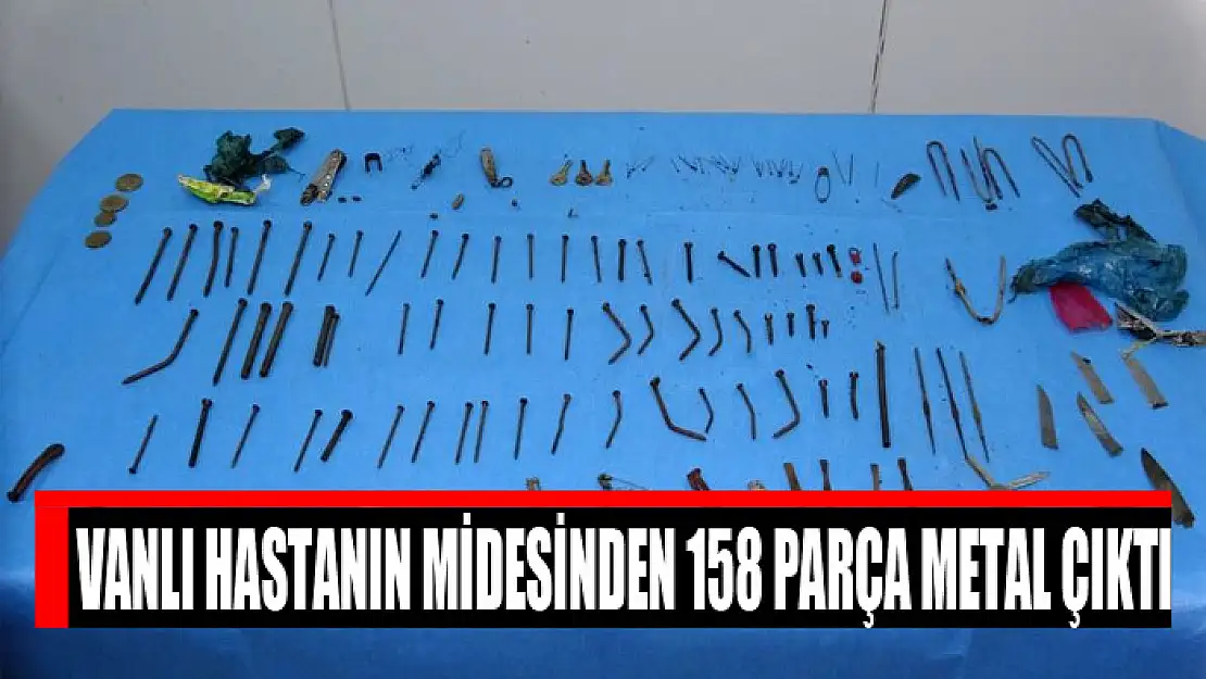 Vanlı hastanın midesinden 158 parça metal çıktı