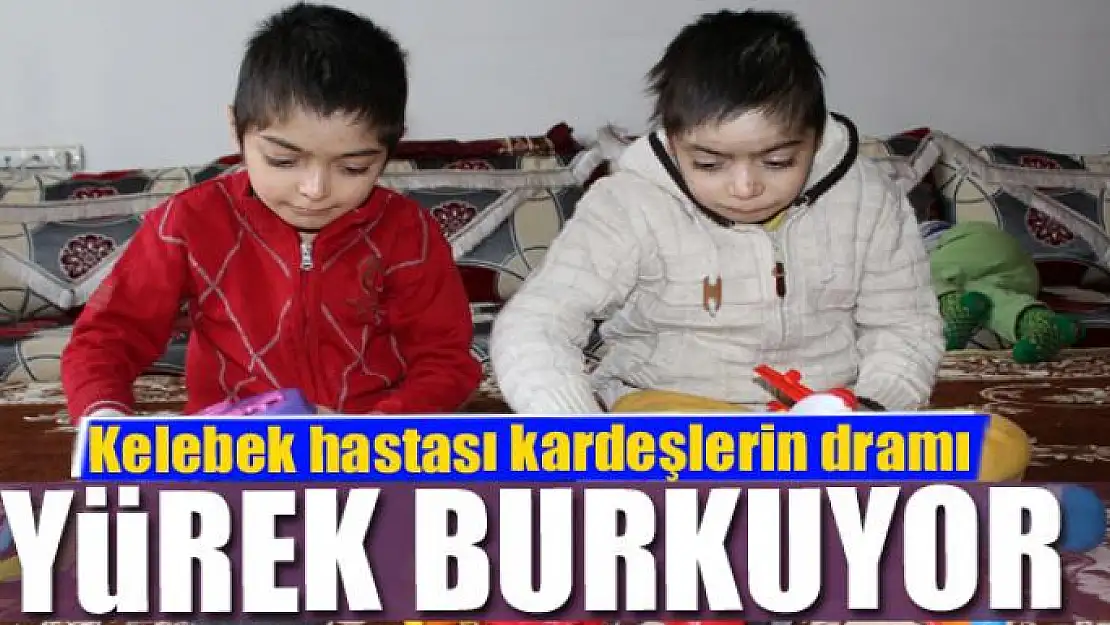 Kelebek hastası kardeşlerin dramı yürek burkuyor