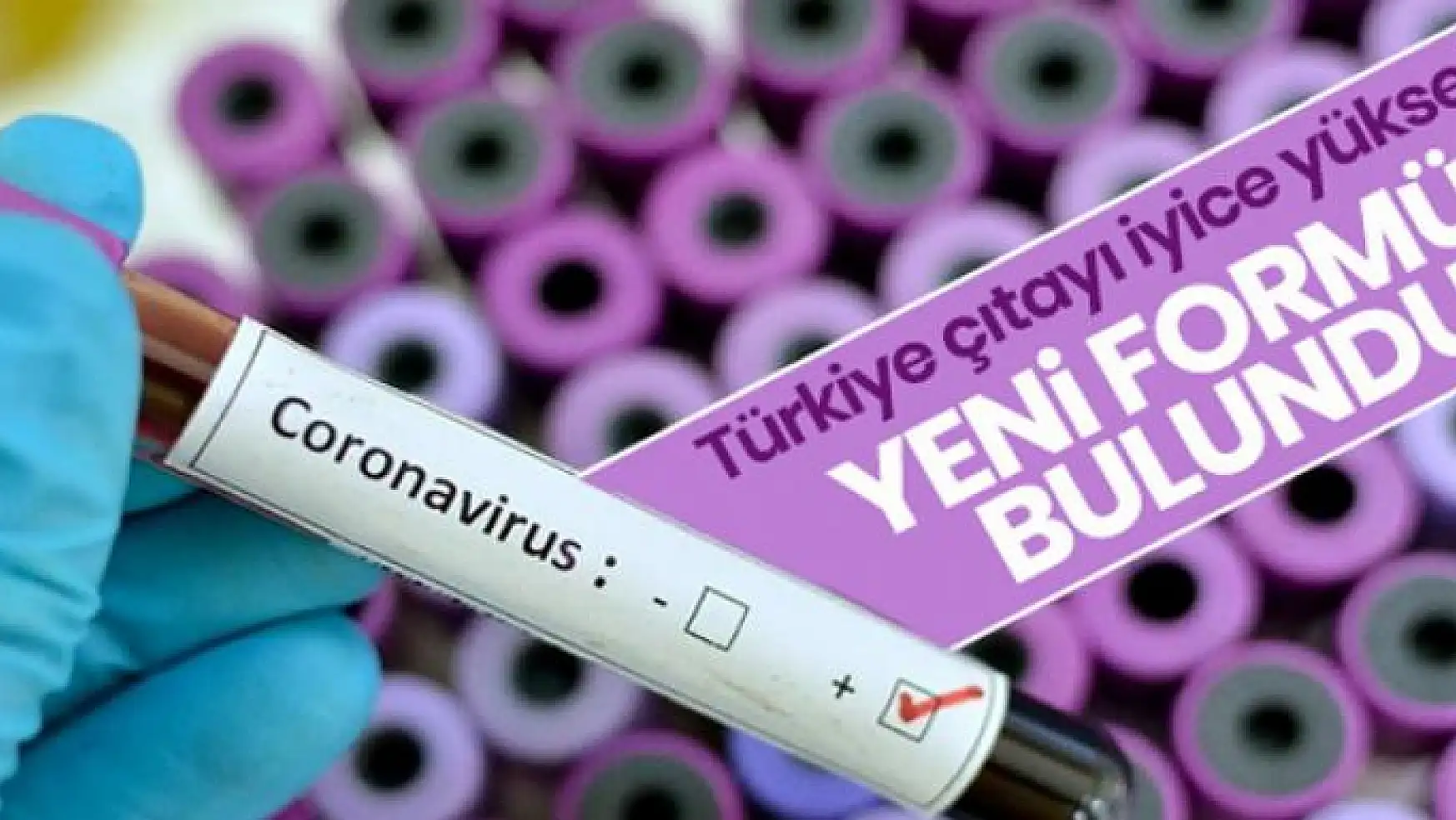 Türkiye koronavirüste çıtayı iyice yükseltti: Kaydırma formülü