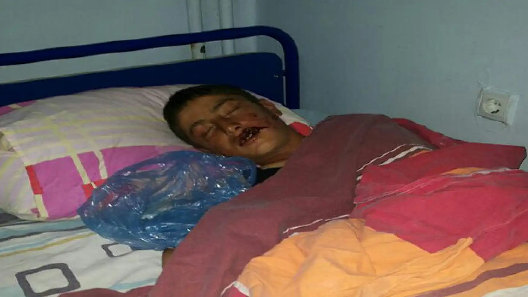 Van'da Kurt Dehşet Saçtı: 2 Yaralı