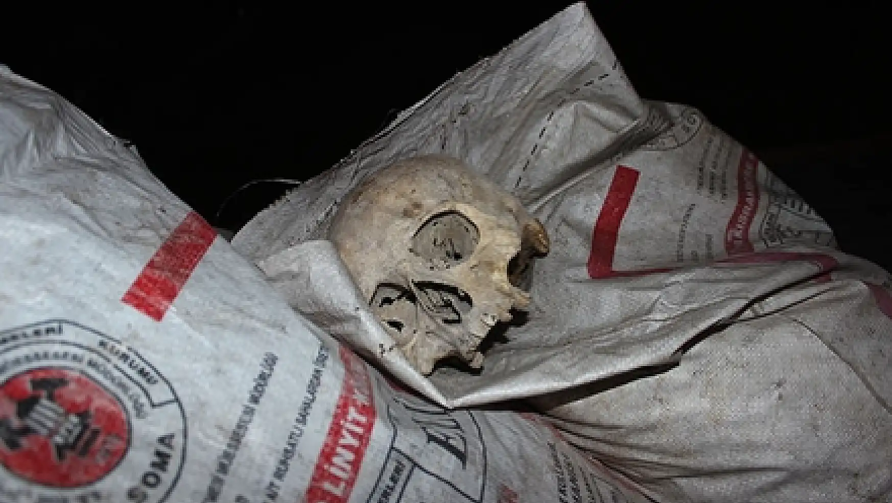 Çöp konteynerinde kafatası bulundu