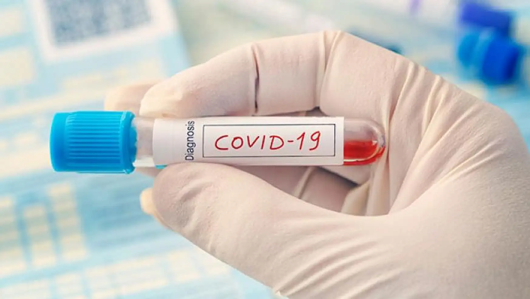 Rusya'da Covid-19 aşısının klinik denemeleri tamamlandı! Aşı Ekim ayına hazır olacak