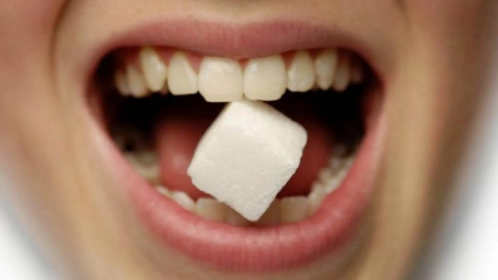 Şeker tüketimi tüm diş sağlığımız üzerinde 'yıkıcı' bir etkiye sahiptir