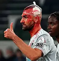 Serdar Dursun ve Jerome Opoku hava topu mücadelesinde çarpıştı