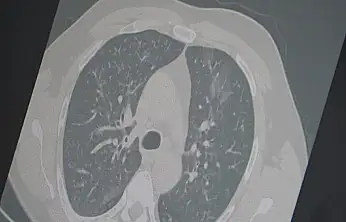 Profesör uyardı: 3'lü salgına dikkat!