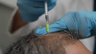 Dökülen saçlar vücudun bir alarmı olabilir