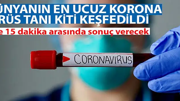 Dünyanın en ucuz korona virüs tanı kiti keşfedildi