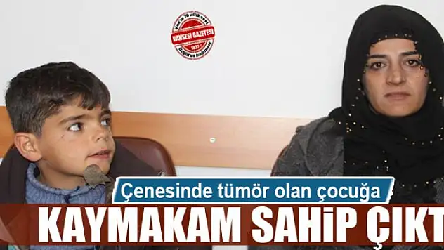 Çenesinde tümör olan çocuğa kaymakam sahip çıktı