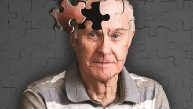 Alzheimer'ın 10 belirtisi ve tedavi yöntemleri