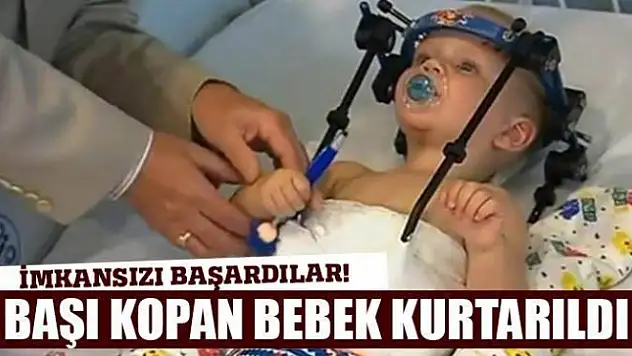 Başı kopan bebek kurtarıldı