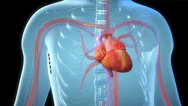 Kalp kapağında dikişsiz ameliyat