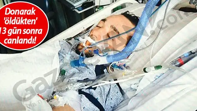 Donarak 'öldükten' 13 gün sonra canlandı!