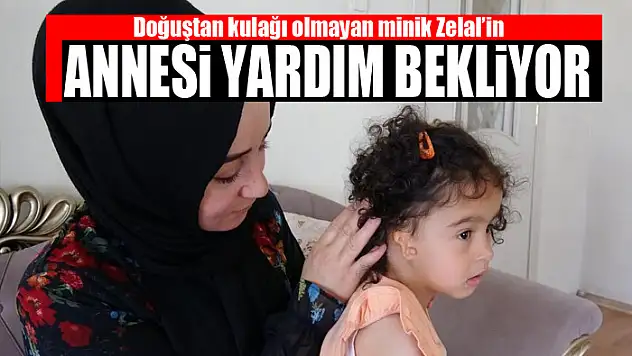 Doğuştan kulağı olmayan minik Zelal'in annesi yardım bekliyor