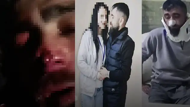 Darp edilen adamın kulağı ve burnu koptu