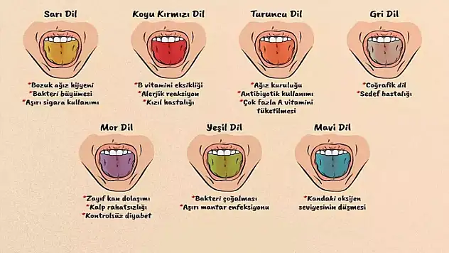 Dilinizin rengi pek çok hastalığın habercisi olabilir