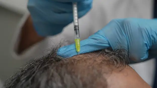 Dökülen saçlar vücudun bir alarmı olabilir