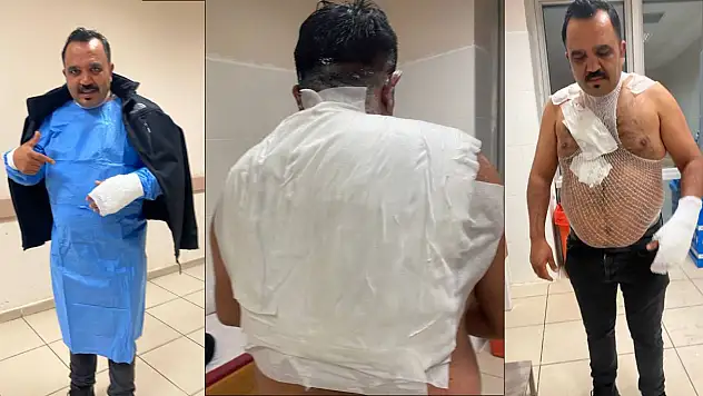 Meşhur tostçu, soğuk havada şov yapmak isterken kendini yaktı