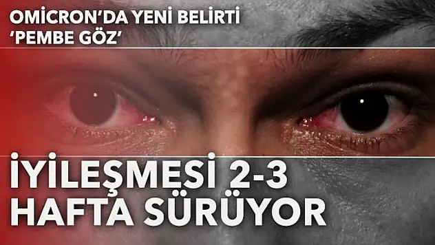 Omicron'da yeni belirti 'pembe göz': İyileşmesi 2-3 hafta sürüyor