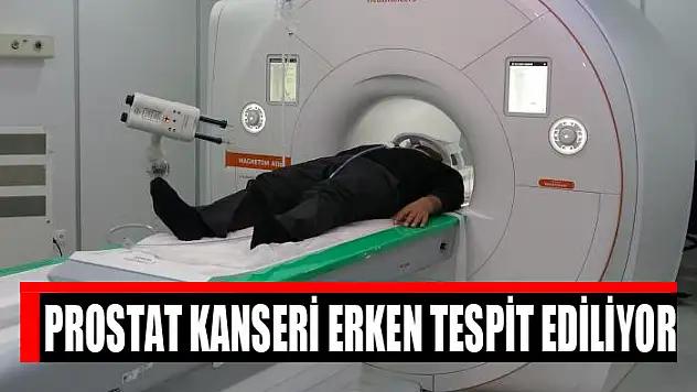 PROSTAT KANSERİ ERKEN TESPİT EDİLİYOR