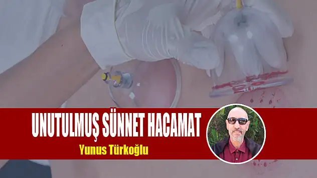 Unutulmuş Sünnet Hacamat