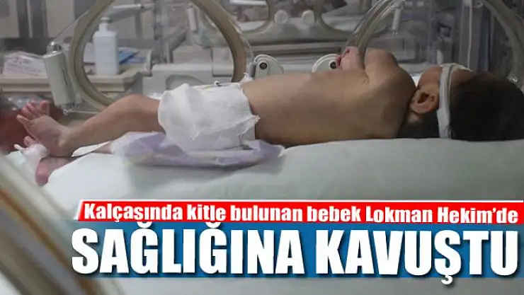 Kalçasında kitle bulunan bebek Lokman Hekim'de sağlığına kavuştu