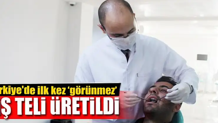 Türkiye'de ilk kez 'görünmez' diş teli üretildi