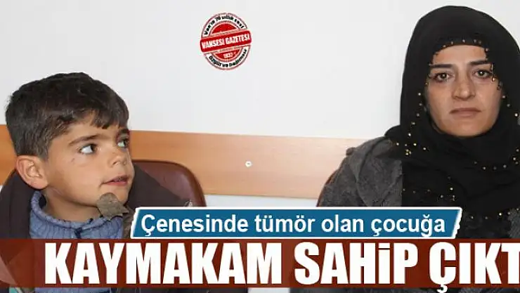 Çenesinde tümör olan çocuğa kaymakam sahip çıktı