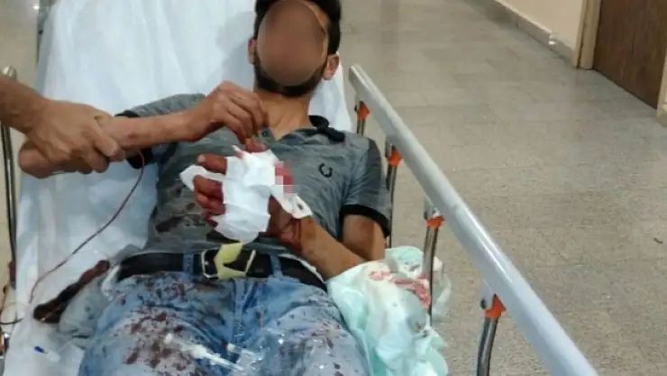 Hazırladığı patlayıcı elinde patladı